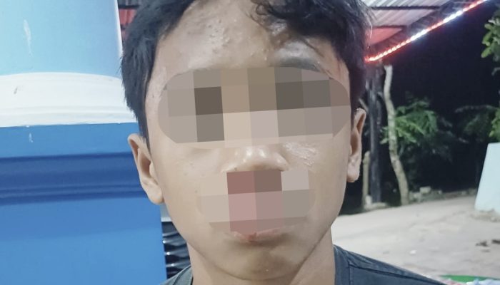 Bocah di Sumenep Diduga Dianiaya Pemuda Gegara Layangan Putus